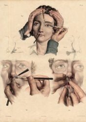 atlas-anatomia-humana-cirugia-08