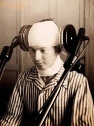 paciente-manicomio_diatermia-cerebral-lateral