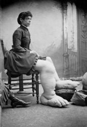 charles-eisenmann_mujer-pies-grandes